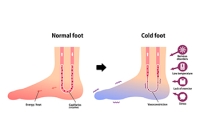 Cold Feet May Indicate Raynaud’s Phenomenon